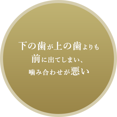 下の歯が上の歯よりも前に出てしまい、噛み合わせが悪い