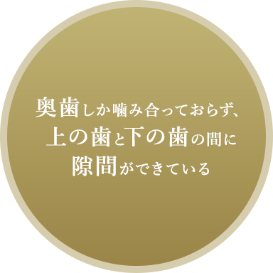奥歯しか噛み合っておらず、上の歯と下の歯の間に隙間ができている