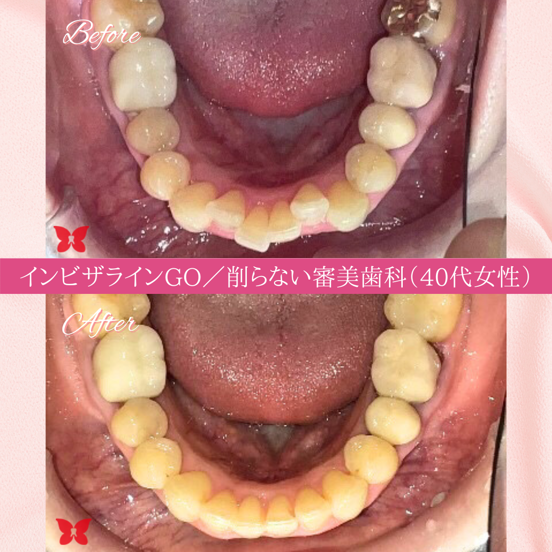 症例紹介01-1
