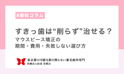 すきっ歯は“削らず”治せる？マウスピース矯正の期間・費用・失敗しない選び方